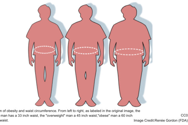 Illustration of obesity and waist circumference. From left to right, as labeled in the original image, the "healthy" man has a 33 inch waist, the "overweight" man a 45 inch waist,"obese" man a 60 inch (152cm) waist.